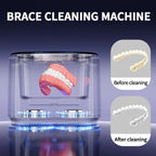 Multifunctional USB Ultrasonic Electric Cleaner for Dentures, Orthodontic Appliances, and Invisible Retainer Cases - Dental Care